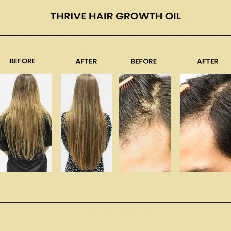 Natural Hair Growth Oil