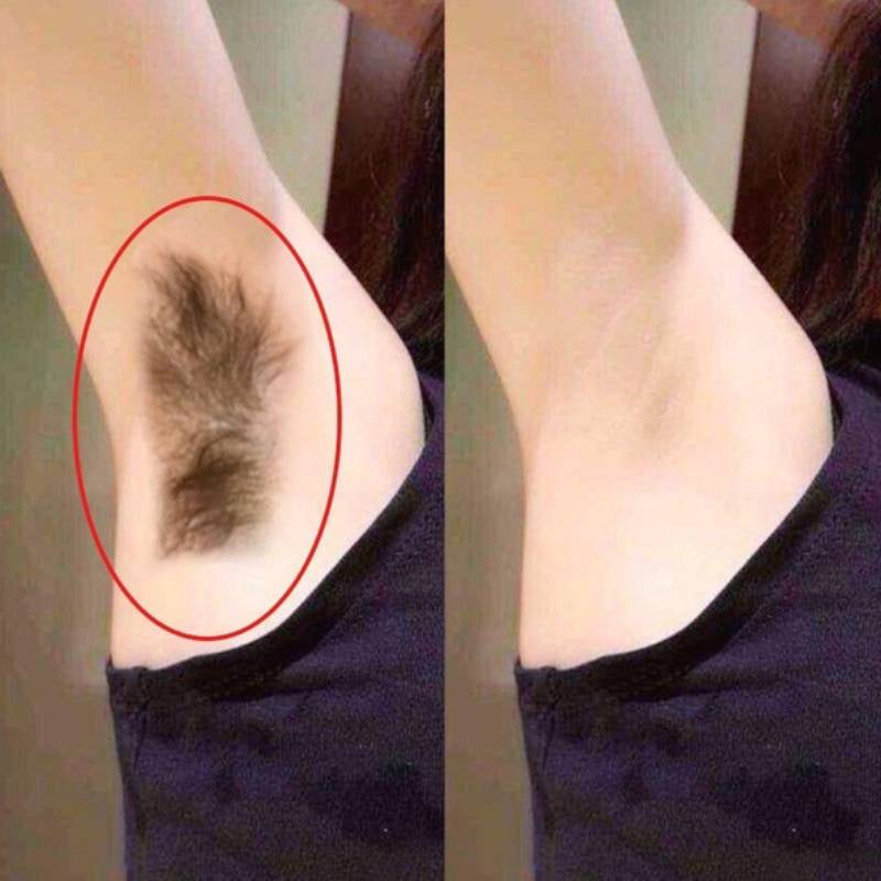 Powerful and Painless Hair Removal Spray